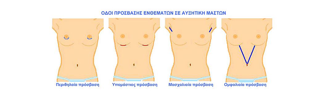 odoi prosvasis enthematon