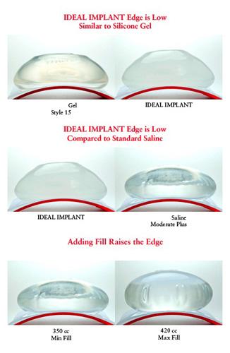 Σύγκριση ενθεμάτων